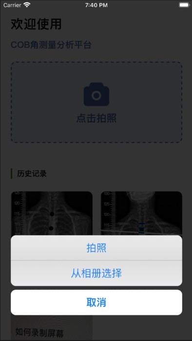 cobb角测量分析平台app截图1