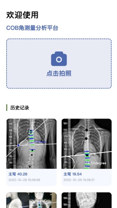 cobb角测量分析平台app截图2