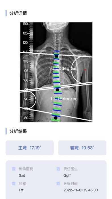 cobb角测量分析平台app截图4