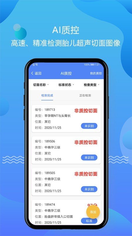 超声智库官方版截图2