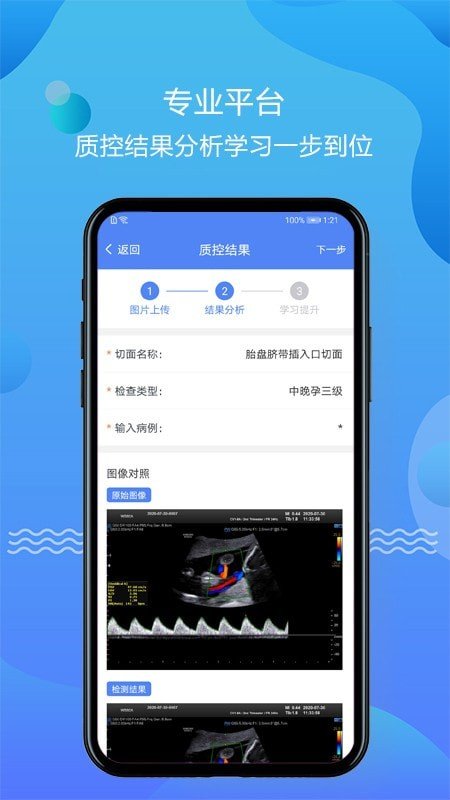 超声智库官方版截图4
