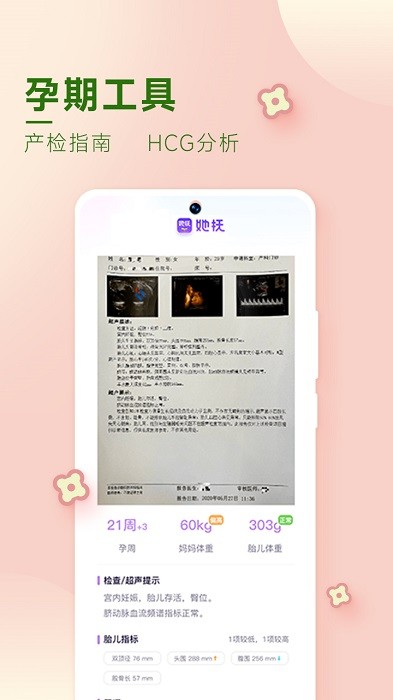 她抚孕育app截图1