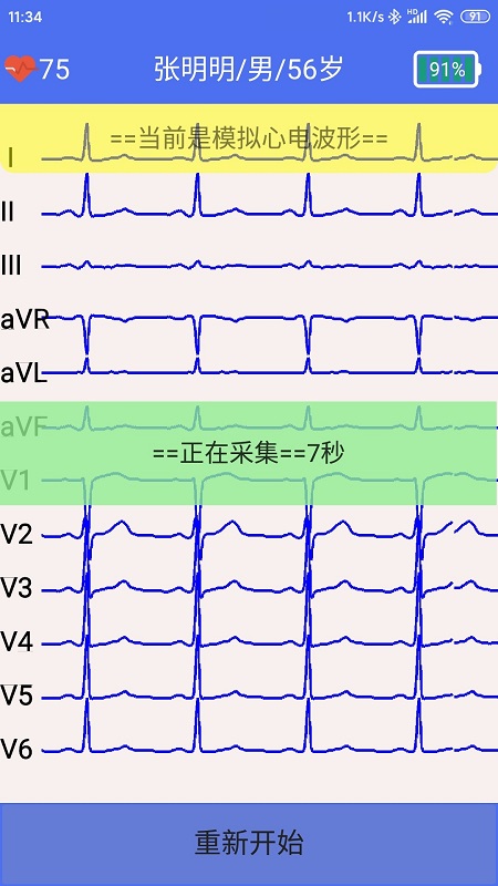 健康2030智能读图心电图系统app截图2