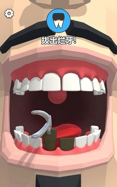 拔牙吗我贼6手机版截图4