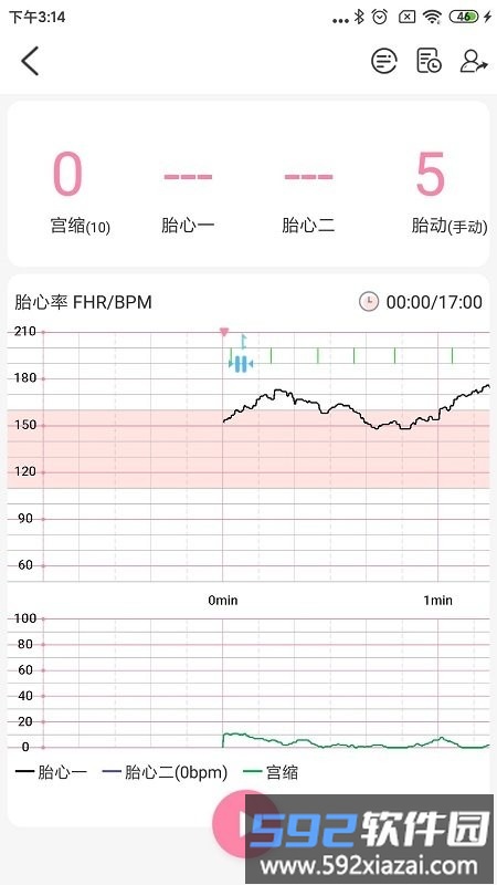 十月宝贝胎心监护医生截图1