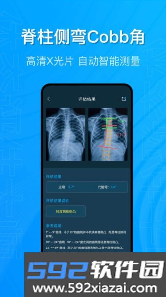 体态评估大师官方版截图3